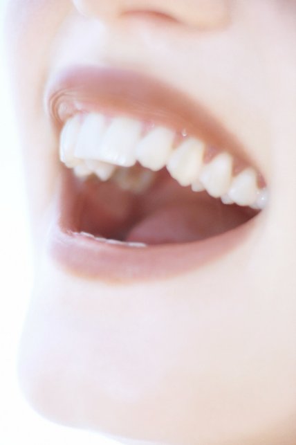 Are Porcelain Veneers Permanent?
