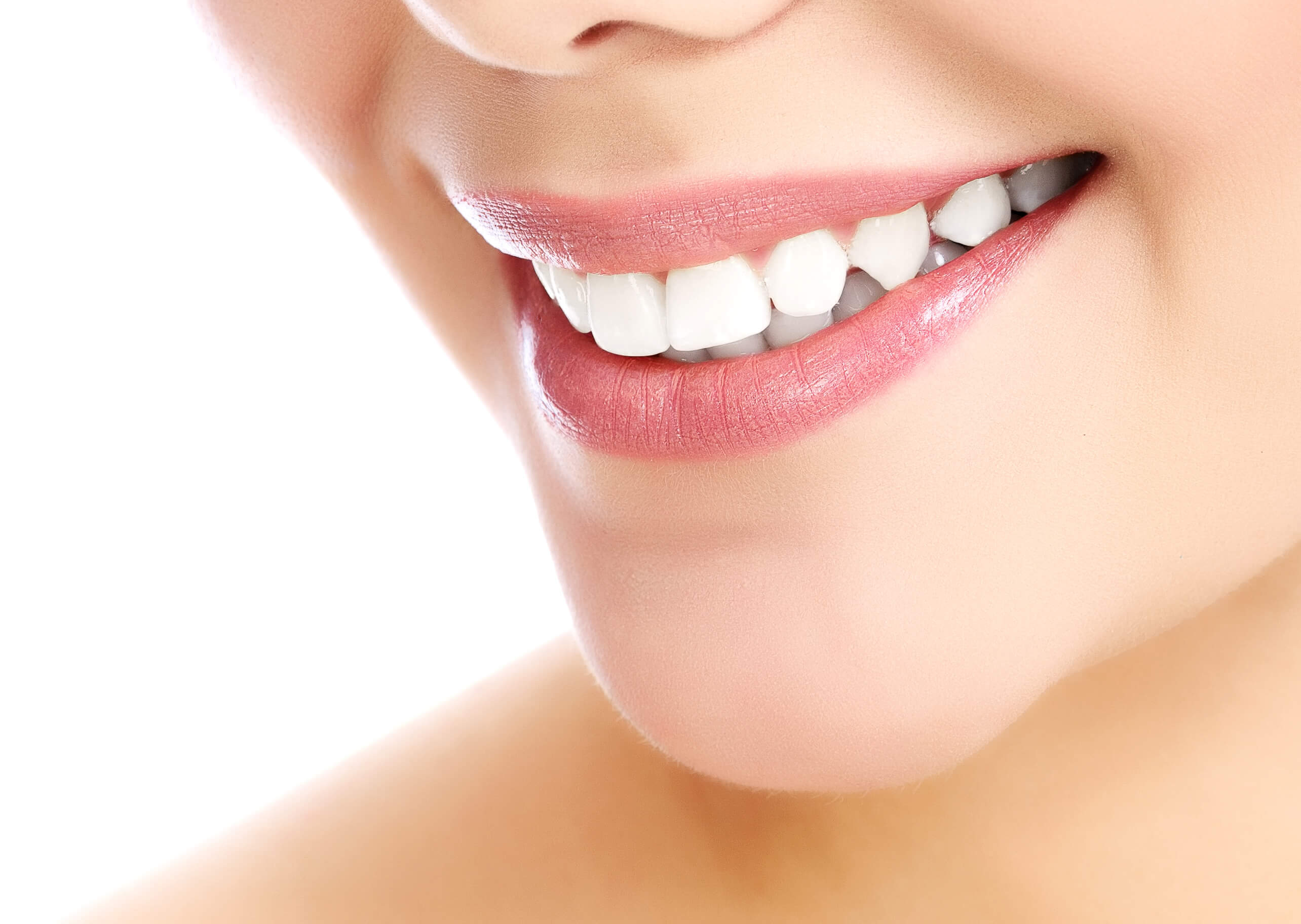 dental fillings in Calgary Tooth Colored Fillings in Calgary