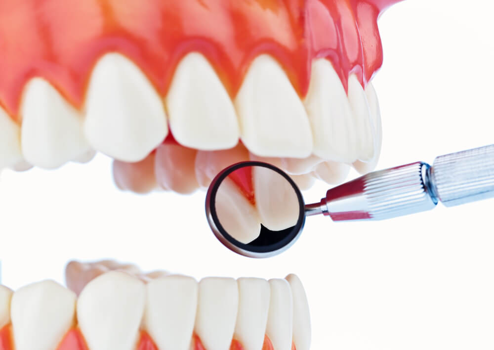 Calgary TMJ specialist Southcentre Dental TMJ specialist in Calgary