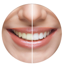 A Beautiful Smile with Teeth