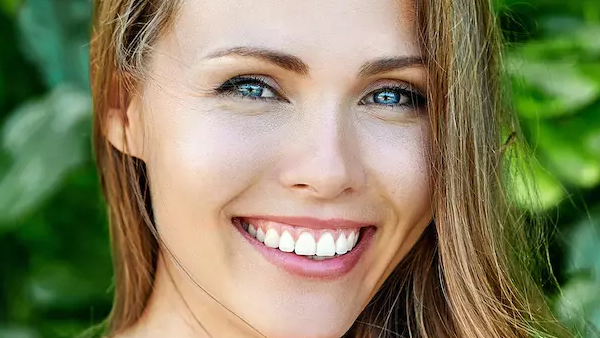 Veneers in Calgary