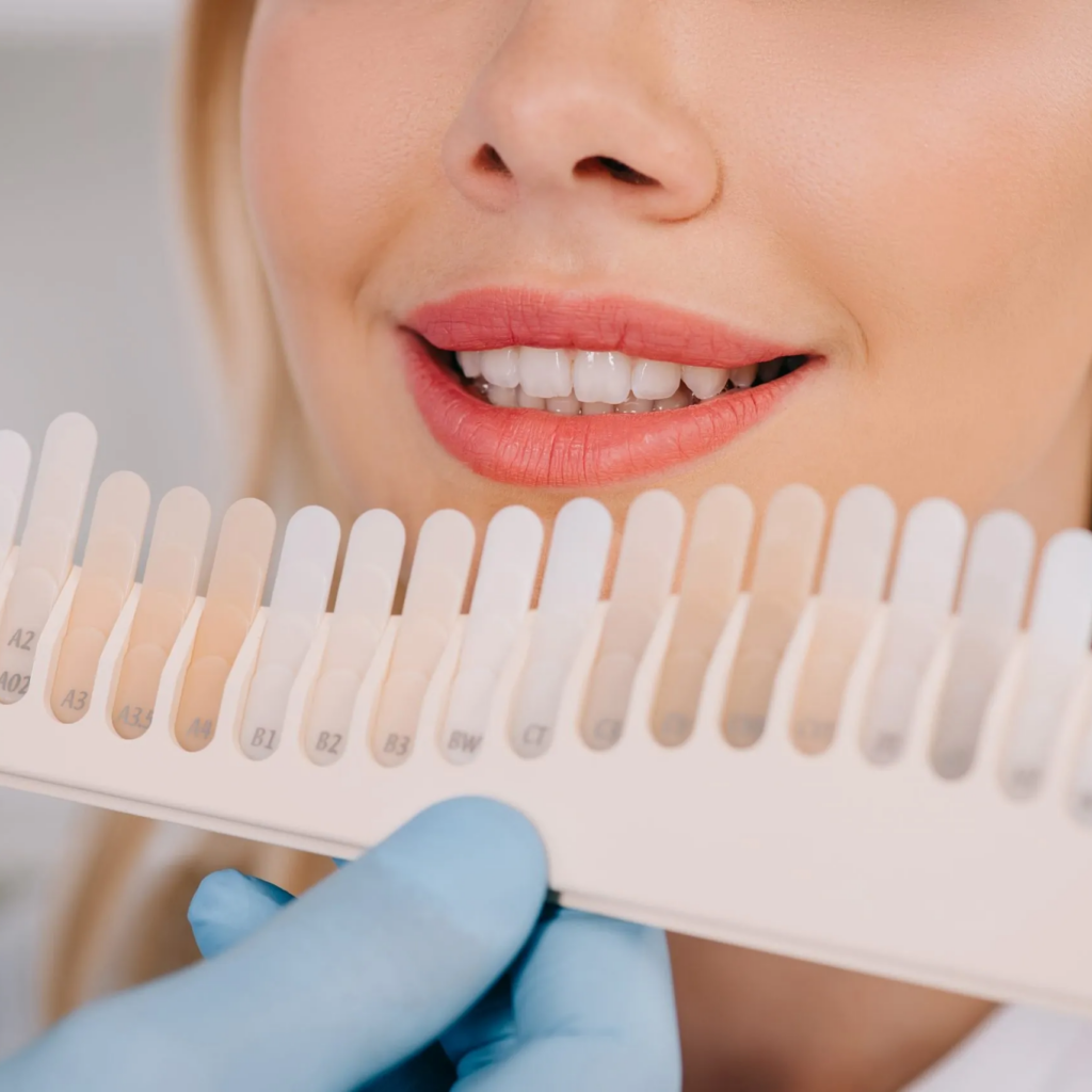 Teeth Whitening Calgary